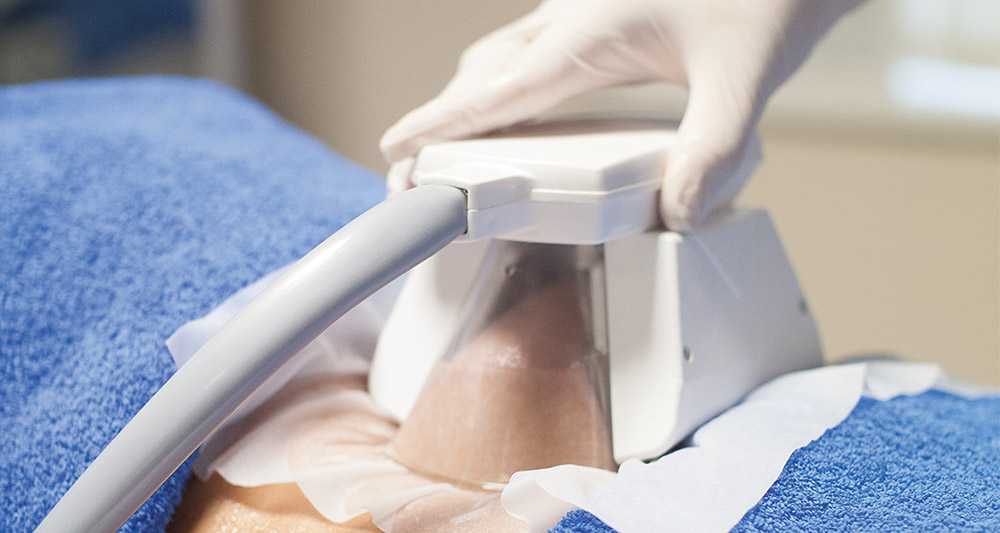 How Fat Freezing and HIFU Work Together? 2 Multiple Areas in One Session HIFU and Fat Freezing Rainham