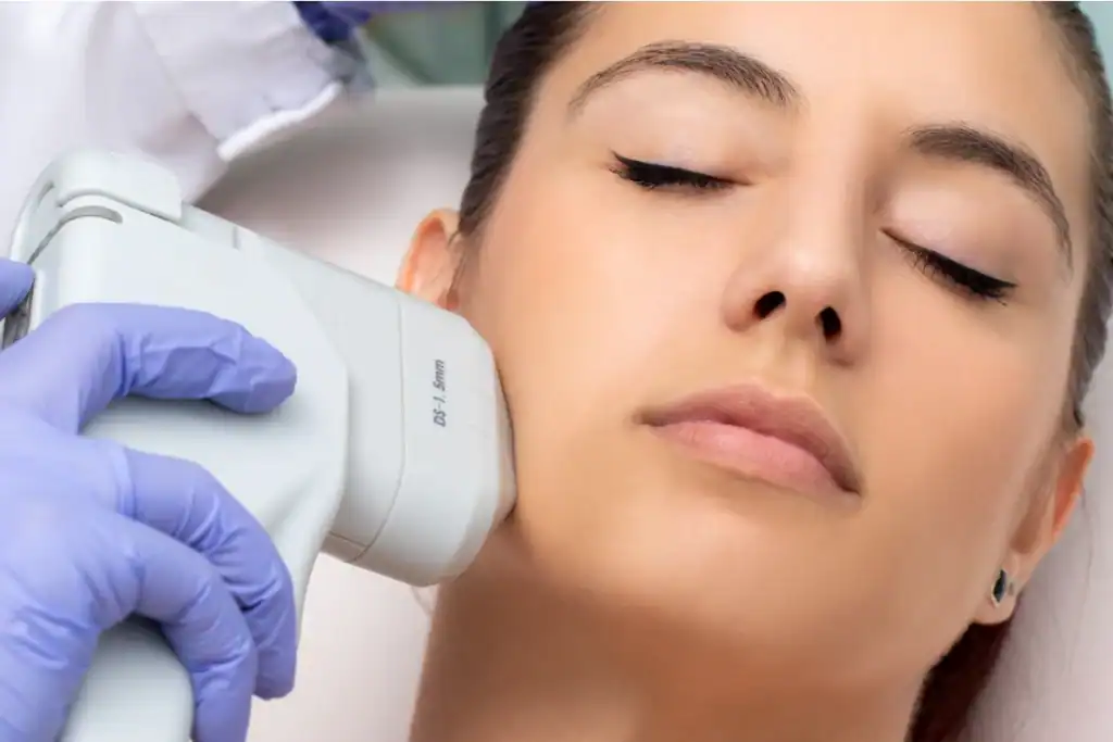 Discover the Perfect Duo: RF Microneedling and HIFU 2 Image of Morpheus8 And HIFU Combined with Lipo 360 Rainham