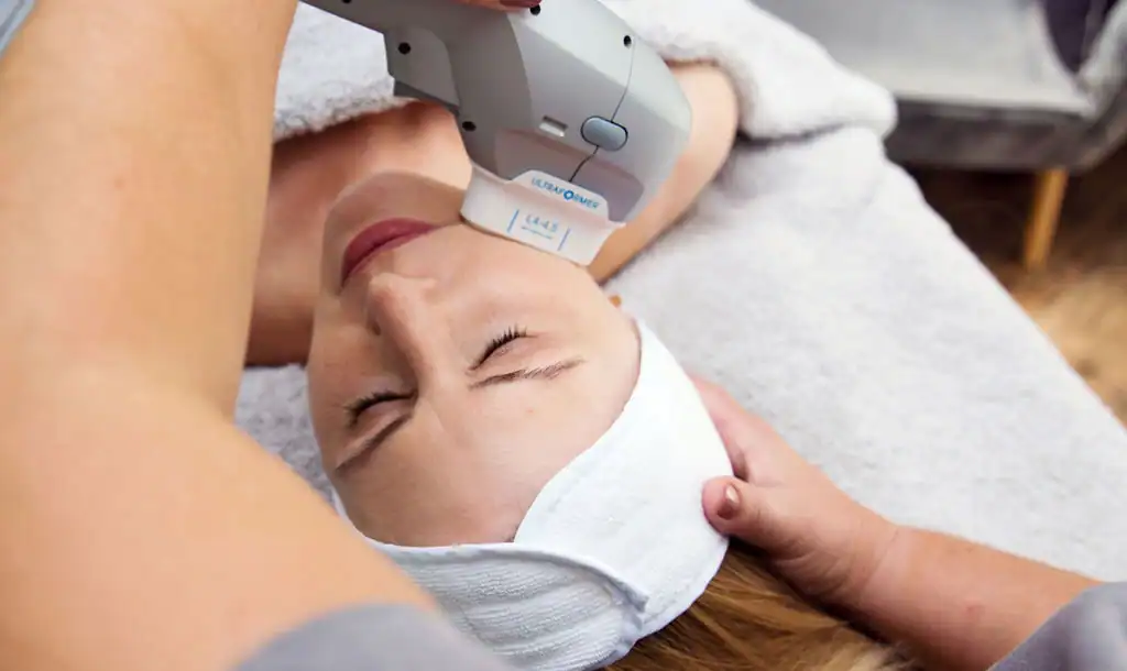 Discover the Perfect Duo: RF Microneedling and HIFU 1 Image of Morpheus8 And HIFU Rainham combined treatment